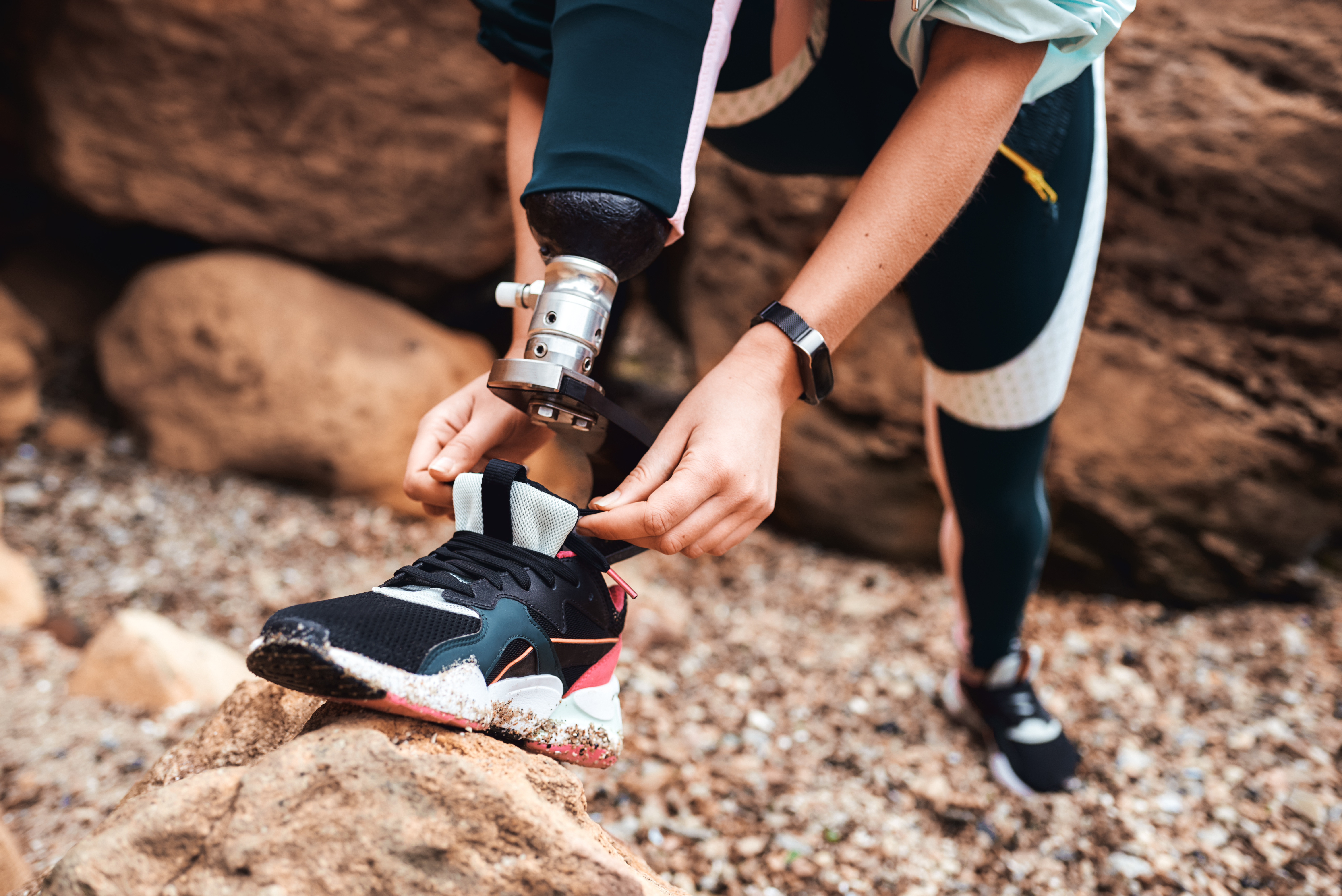 Prosthetic Training with Outpatient Physical Therapy